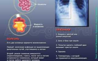 Признаки пневмонии на снимке кто