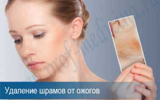 Убрать следы от ожогов лазером