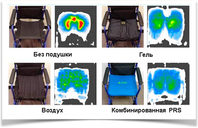 Инвалидное кресло