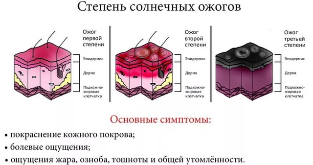 Средство от солнечных ожогов на бали