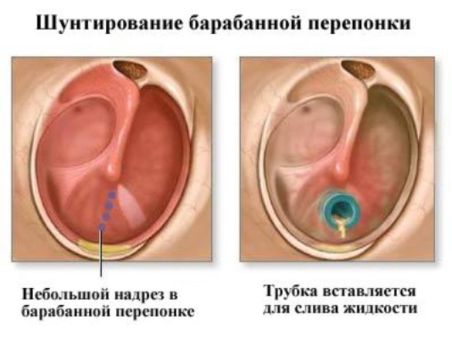 хирургическая операция